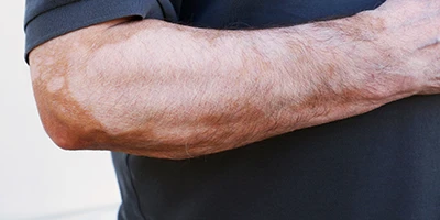 brazo-2,1-400×200