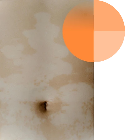 ombligo-adorno-2,3-400×450